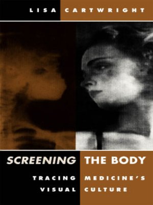 cover image of Screening the Body
